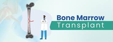 Bone Marrow Transplant in India
